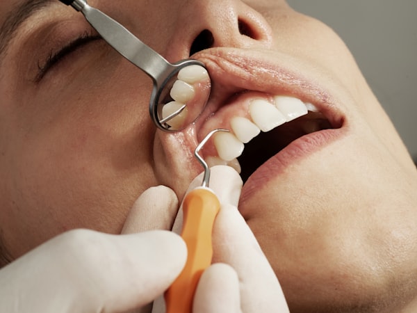 Smile Makeover